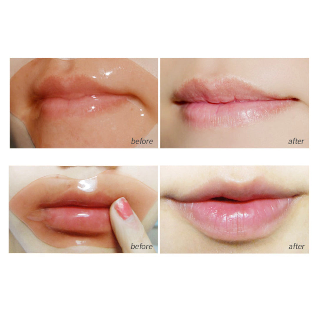 Brille lip care system set_lip gel patch